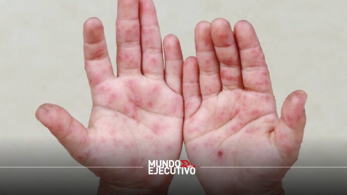 virus coxsackie Puebla